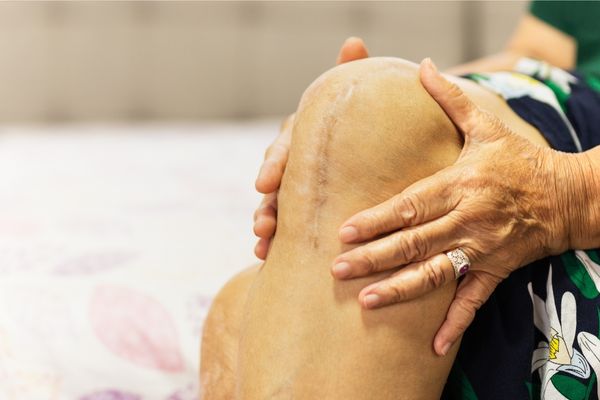 Knee arthroplasty
