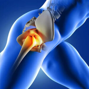  Hip-Prosthesis-Surgery-Post-Physical-Therapy