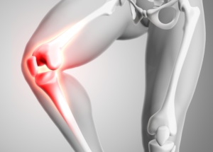 Why does a knee prosthesis loosen?