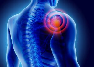 omuz ağrısı nedenleri