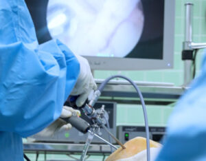 آرتروسکوپی جراحی زانو بسته