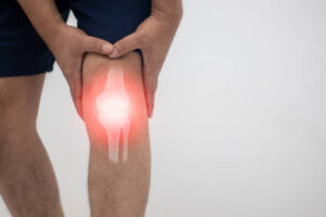 После артроскопии коленного сустава