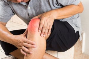 Лечение артрита коленей