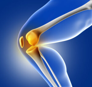 Преимущества роботизированного протеза коленного сустава