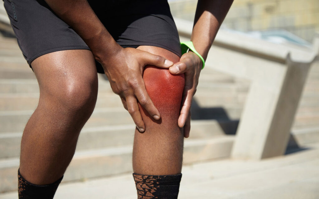 Prepatellar Bursit Nedir?