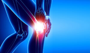 What is Anterior Cruciate Ligament Surgery?