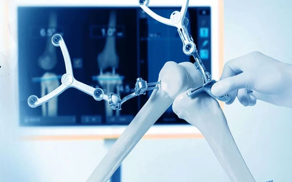 Robotik Diz Protezi Ameliyatı