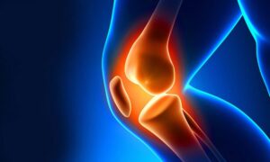 What is Meniscus Surgery?