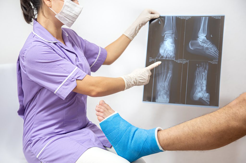 Halluks Valgus Ameliyatı: Ayak Sağlığınızı Ne Zaman Geri Almalısınız?-