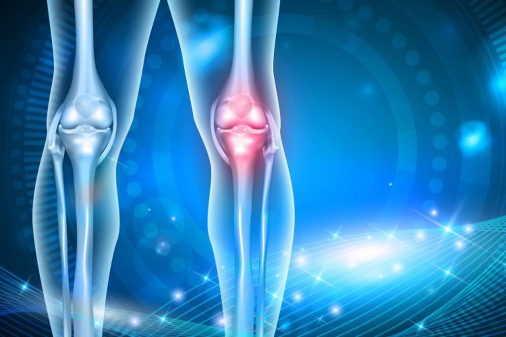Kireçlenme (Osteoartrit) Tedavisinde Cerrahi Yaklaşımlar: Ne Zaman, Hangi Çözüm?