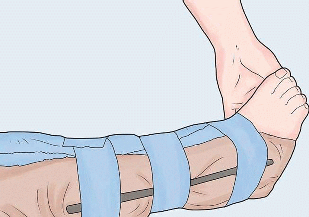 Kırık ve Çıkıklarda İlk Müdahale Nasıl Olmalı? Hayat Kurtaran İpuçları ve Uzman Önerileri