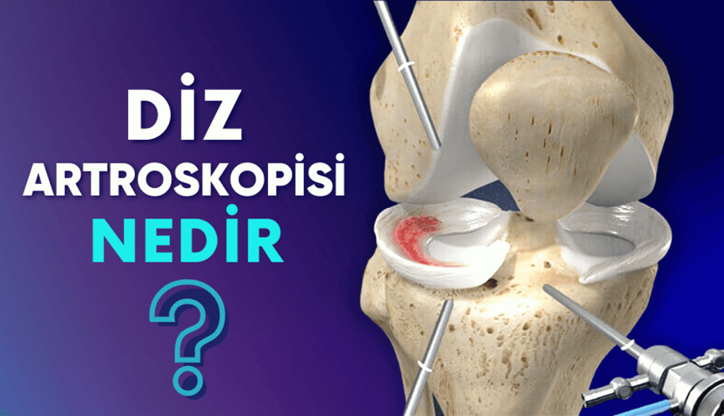 Artroskopik Cerrahi ile Açık Ameliyat Arasındaki Fark